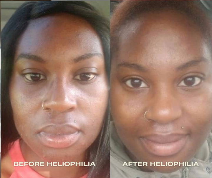 
                  
                    Heliophilia Glow & Fix Serum
                  
                