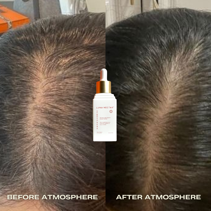 
                  
                    Atmosphere Multi-Peptide Hair Density & Scalp Serum
                  
                