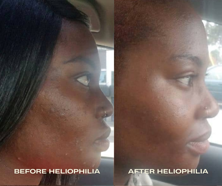 
                  
                    Heliophilia Glow & Fix Serum
                  
                
