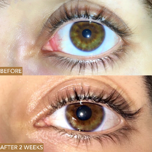 
                  
                    Cruelty free lash serum
                  
                