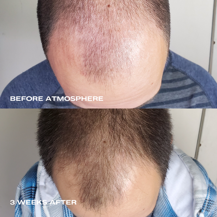 
                  
                    Atmosphere Multi-Peptide Hair Density 3-Pack
                  
                