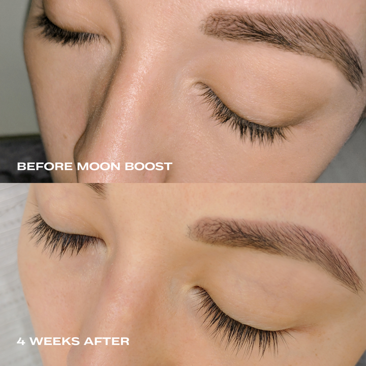 
                  
                    eyelash serum without prostaglandin
                  
                