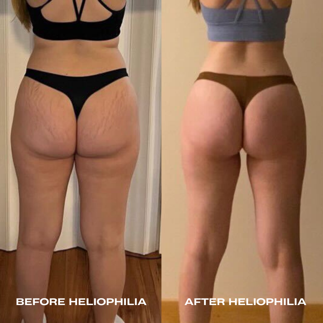 
                  
                    Heliophilia Glow & Fix Serum
                  
                